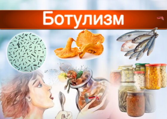 Внимание. Ботулизм.. Внимание. Ботулизм..